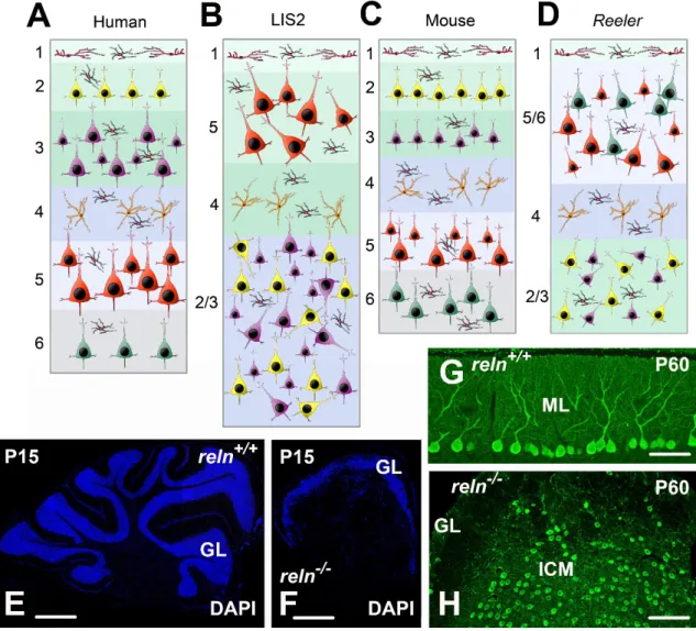 Figure 2. Structural alterations in human, LIS2, and homozygous Reeler mouse (A–D); modifications  of the neocortex architecture in human LIS2 (B); and Reeler  mutation (D); compared to healthy  controls (A, C)