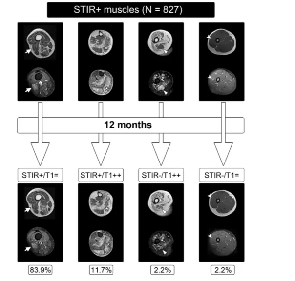 Figure 2 Evolution of STIR+ muscles at baseline. Patients (left to right) 80, 40, 9, 5, and 24