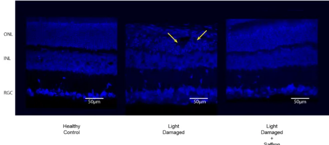 Figure 1. Nuclear staining (DAPI) of Control (left), Light damaged (center) and Light damaged  treated with Saffron (right)