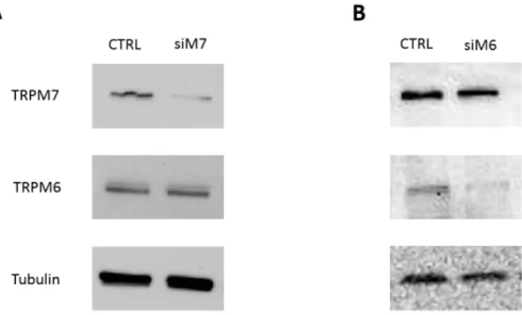 Figure 2. Specific short interfering RNA (siRNA) transfection efficiently downregulates TRPM7 and  TRPM6  in  human colon  cells