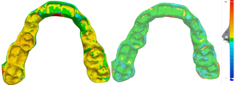 Figure 5. Example of deviation analysis detected after superimposition of the 3D-printed splint (left)  and milled splint (right) with the original digital project (evaluation of the trueness)