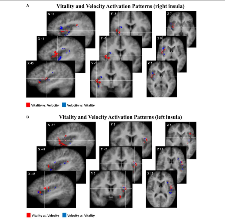 FIGURE 5 | Maps group of 50% of most discriminative voxels for the perceptual difference of vitality forms (red) and velocity (blue) collapsing three different contrasts (rude vs
