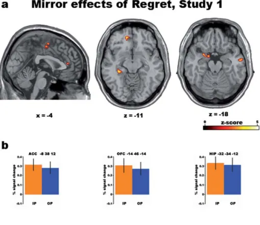 Figure 2. Common parametric effects of regret in Studies 1 and 2. Activations linearly and positively related to the objective amount of regret (measured as the difference between the outcomes of the chosen and unchosen gambles) in both the IP (minus IF) a