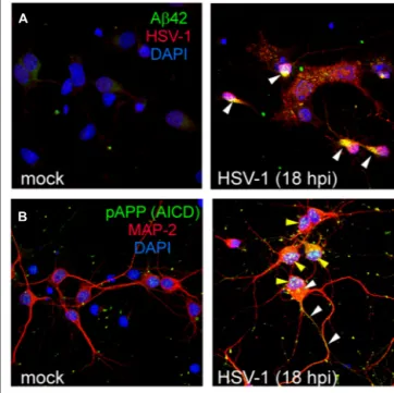 FIGURE 2 | HSV-1 infection induces intracellular accumulation of several APP fragments