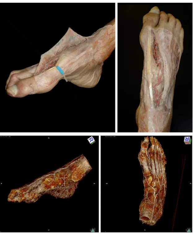 Fig. 10 Vista TC scout di un preparato anatomico di gamba dopo iniezione del mezzo  di contrasto
