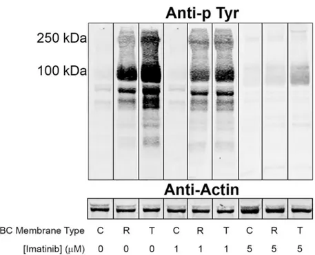 Fig 2. Effect of imatinib on tyrosine phosphorylation of band 3 in P. falciparum infected
