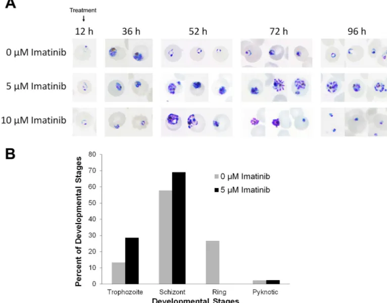 Fig 3. Effect of imatinib treatment on P. falciparum maturation and egress. Synchronized ring stage parasites (12 hours after parasite invasion) were either left untreated (top row) or treated with 5 μM (middle row) or 10 μM (bottom row) imatinib, and para