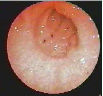 Fig. 4 Erosioni a graffio di gatto