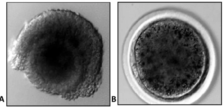 Figure 4.1.: Sheep oocytes: A) Germinal Vesicle (GV) and B) metaphase II (MII) stage 