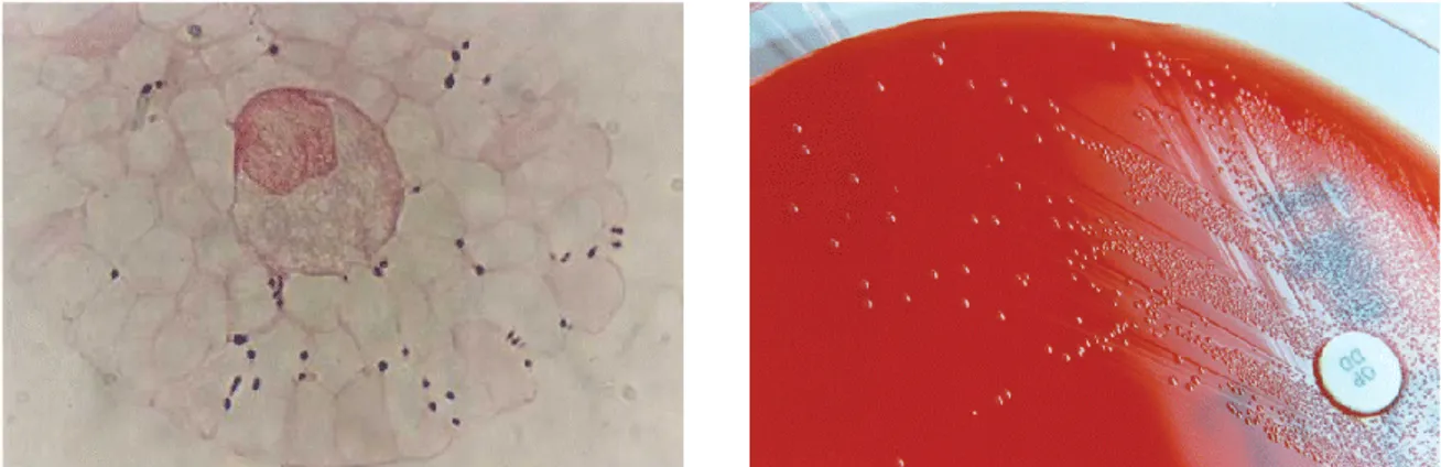 Figure  2.  Gram-positive  cocci (Streptococcus  suis),  single  or  in  pairs,  visible  in  direct  Gram stain of a CSF sample (original magnification, ×100; left)