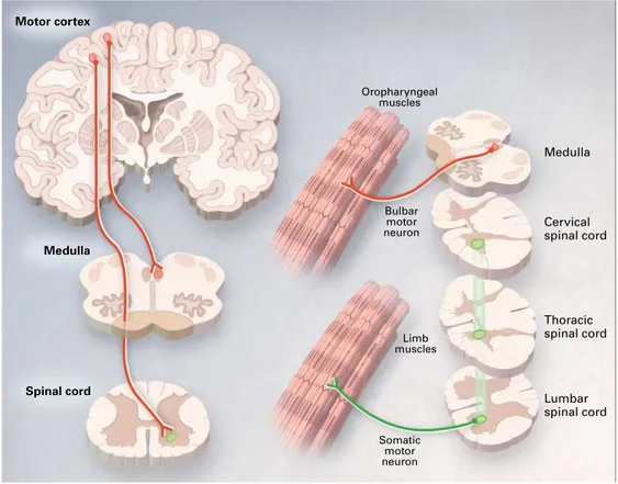 Figure 1.  Motor Neurons Selectively Affected in ALS.