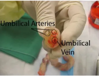 Figure 3.1 Human umbilical vein and arteries 
