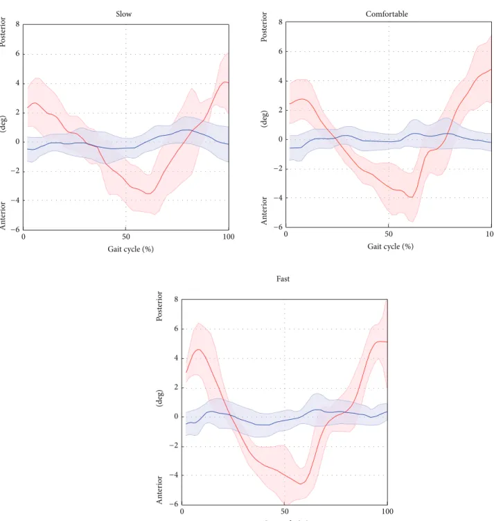 Figure 7: Pelvic tilt averaged over subjects and trials for the selected gait speed (average: solid lines; SD: shaded area; red = ML; blue = Plug in Gait protocol).
