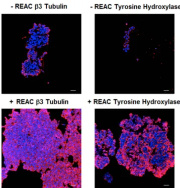 Figure 3.  REAC TO-RGN induces PC12 differentiation toward neural phenotype. Expression of β -3-tubulin  and Tyrosine Hydroxylase were assessed in cells cultured in the absence or presence of REAC TO-RGN  treatment, for 168 h (7 days)
