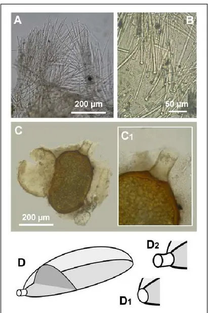 Figure 6. Protosuberites sp.. Skeleton, spicules and gemmule-like resting bodies. A. Skeletal  architecture with tylostyles arranged arranged in bundles