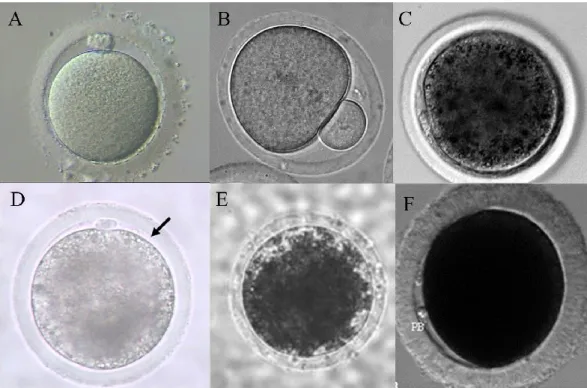 Fig 1.2: Diverso contenuto lipidico in ovociti in diverse specie: uomo (A); topo ( B);pecora  (C) bovino (D); bovino; maiale (E); cane (F)