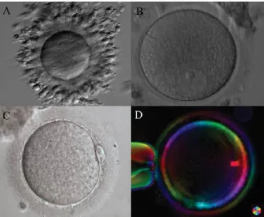 Fig. 1.6: Ovociti umani in diversi stadi meiotici: A-B) vescicola germinale (GV); C) metafase  II (MII); D) Telofase I (TI) visualizzata in microscopia a luce polarizzata (Immagini da Rienzi  et al., 2012) 