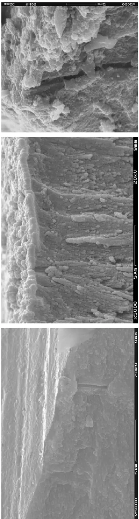 Fig. 5 - SEM micrograph of dentinal tubules.       Fig. 6 – SEM micrograph of occlusion of the exposed tubules or penetration in the tubules by different dental materials