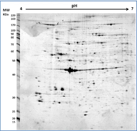 Figure 5: Typical gel image obtained in our lab for PBMCs proteins in 12.5 % gel 