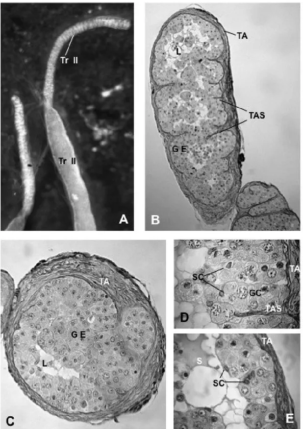 Figure 2. A. High magnification of a single testis of another male showing two different  region