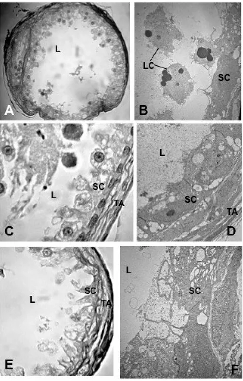 Figure 4. A, C. Paraffin sections of N. ophidion testis showing the the second part of the  testis  and  the  second  testis  region  immediately  below  the  narrowing