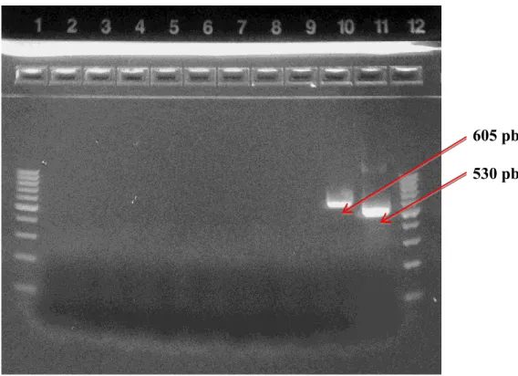 Fig. 17 Prodotti di amplificazione della Nested PCR per il gene Tpi              Line 1-12: Molecular weigth marker 100 bp 