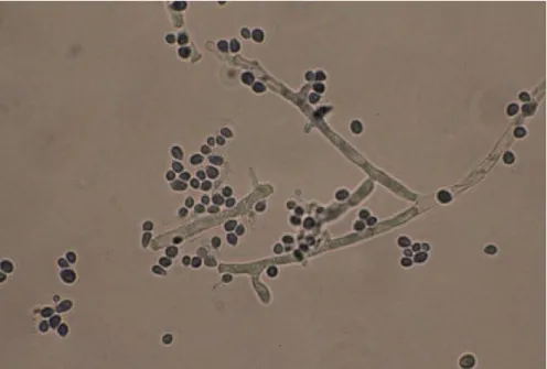 Fig. 2.8 - Conidi e conidiofori di Beauveria bassiana 