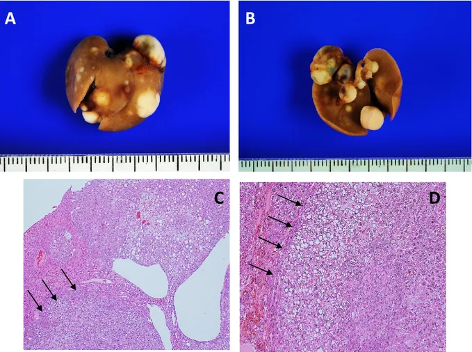 Figura 10. L’iniezione idrodinamica del gene PIK3CA-E545K induce lo sviluppo di lesioni  neoplastiche  multiple  nel  fegato  di  topo  sei  mesi  dopo  iniezione