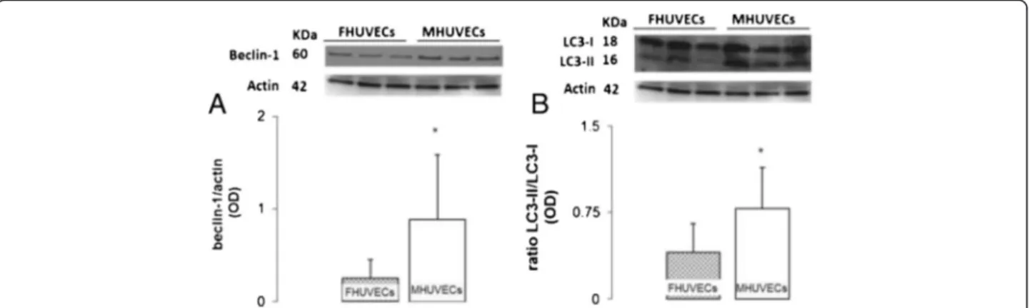 Figure 6 Beclin-1 and LC3II to LC3I ratio in FHUVECs and MHUVECs. (A) Representative Western blot and densitometric analysis of beclin-1 expression