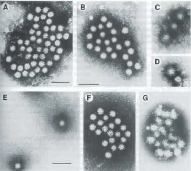 Figura  2.1.  Norwalk  virus  (NV),  in  A:  Norovirus  in  Immune  Electron  Microscopy  (IEM),  Knipe  &amp; 