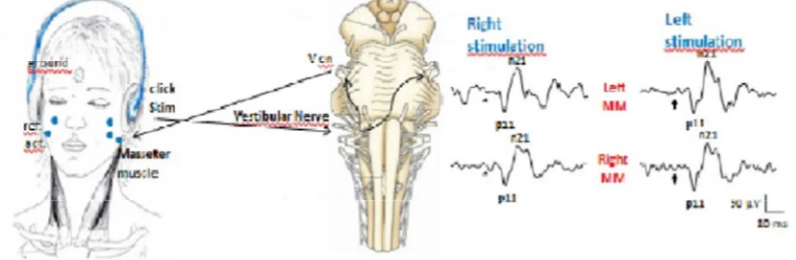 Figura 4 - Schema descrittivo della registrazione del VMR 