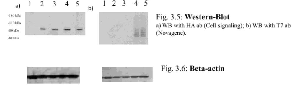 Fig. 3.4 : Co-IP Med1/MBD4 and hSUMO1 after Cisplatin treatment