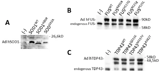 Figure  15:  Cell  lysates  of  SH-SY5Y  cells  after  48  hour  following  infection  with  30  pfu/cell  of  infectious  recombinant  adenoviruses