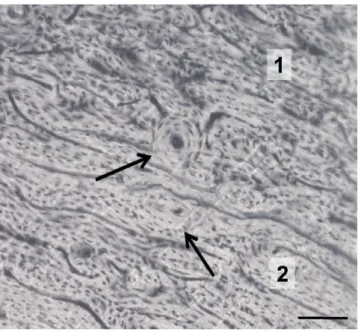 Figure 2. Sheep. Irregular Haversian tissue (1) gradually changes to plexiform tissue (2)
