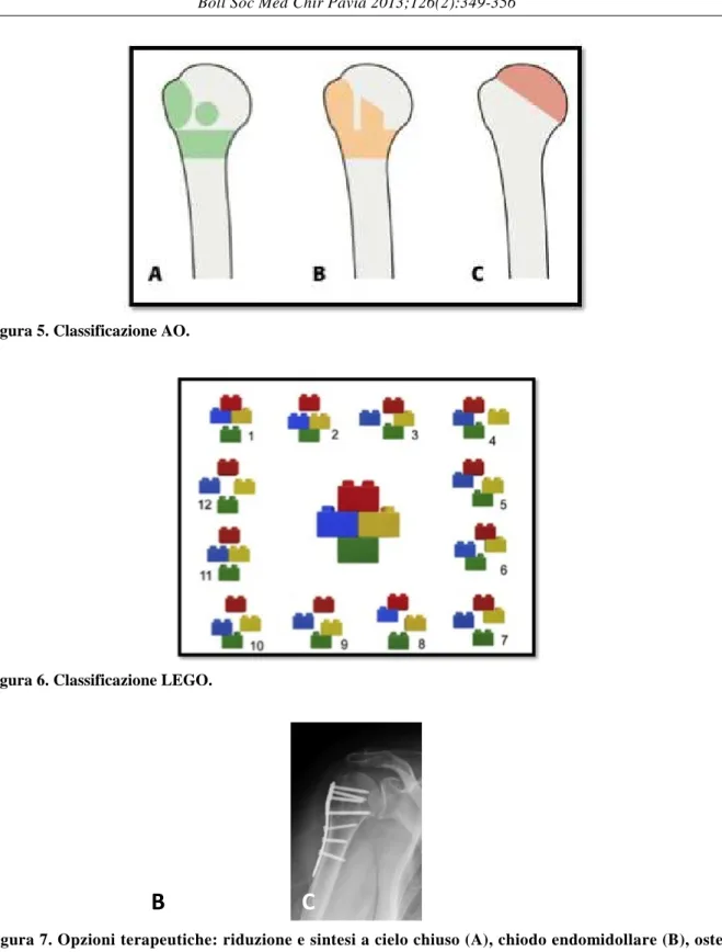 Figura 5. Classificazione AO. 