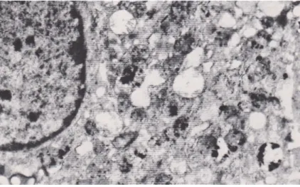 Figura 3. Cellula basofila in prossimità della zona di transizione. È visibile la sottile membrana plasmati- plasmati-ca, il nucleo intatto, abbondante reticolo ergastoplasmatico rugoso e mitocondri variamente alterati:  quel-li con matrice più densa prese