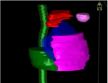Figura 1. Scansione assiale TC con contornamento del  volume bersaglio (rosa) e di alcuni organi a ri- ri-schio:  polmone  sinistro  (blu),  midollo  spinale  e  midollo  espanso  (verde)  ovvero  midollo  spinale  con  margine di sicurezza per ovviare ad 