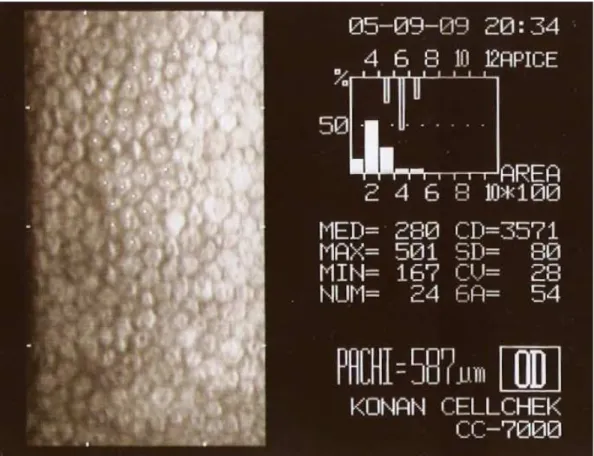 Figura 4. Calcolo di diversi parametri (soprattutto CD, CV e 6A) tramite il metodo di analisi detto centro