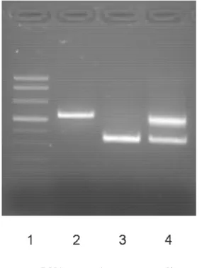 Figura 2. Esperimento condotto su c-DNA: Lane 1: marcatore di peso molecolare; Lane 2: controllo  wt  (unica  banda  di  522bp);  Lane  3:  delezione  dell’esone  10  in  omozigosi  (unica  banda  a  352bp); 