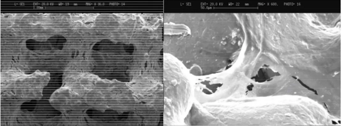 Figura 11. SEM di ASC cresciute sulla superficie e all’interno degli scaffold di titanio trabecolare in pre- pre-senza di terreno osteogenico per 28 giorni (Ingrandimenti: 36x a sinistra e 600x a destra)
