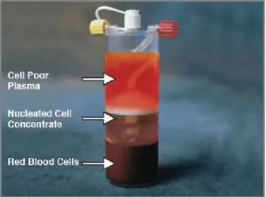 Figura 1. Il concentrato di cellule nucleate interposto tra plasma ed eritrociti a centrifugazione avvenuta