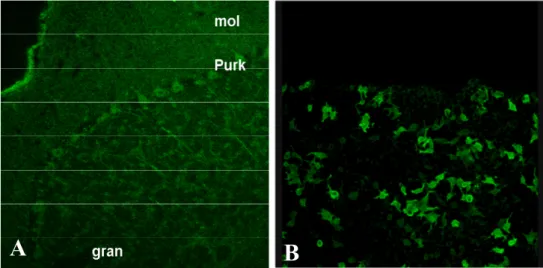 Figura 1. Reattività anticorpale del siero di un paziente con neuromielite ottica: assenza di  legame specifico per NMO-IgG (A) (pattern in immunofluorescenza su tessuto cerebellare  di primate, 200x) e presenza di legame specifico per la proteina acquapor