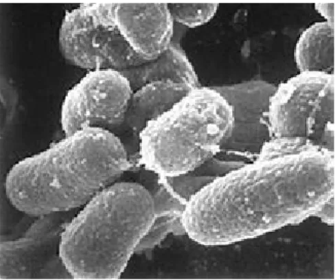 Fig. 2. Mycobacterium avium subspecies paratuberculosis https://johnes.org/