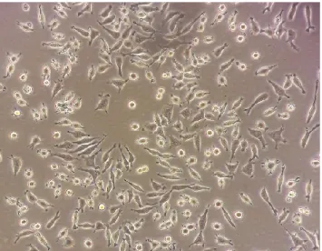 Fig. 16 Particolare di cellule NSC-34 in coltura a 37°C con 5% CO2. Le cellule sono tenute in coltura in DMEM F-12  addizionato di Penicillina, Streptomicina e TET 10%
