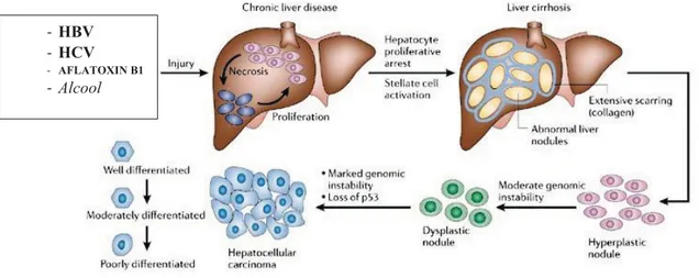 Figura 2. Sequenza cronologica delle alterazioni istopatologiche che conducono ad HCC nell’uomo.