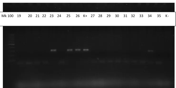 Figura 1. Campioni di miocardio ovino positivi a T. gondii analizzati mediante Nested PCR