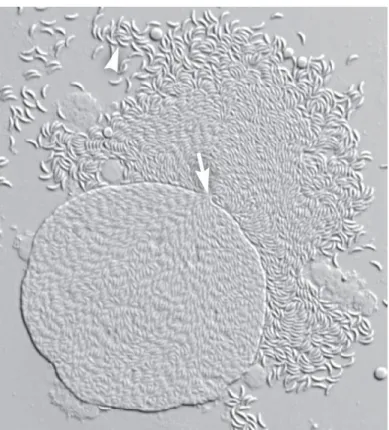 Figura 5. Cisti tissutale di T. gondii rotta meccanicamente che rilascia migliaia di bradizoiti attraverso il foro della parete della cisti  (Dubey J.P., 2010)