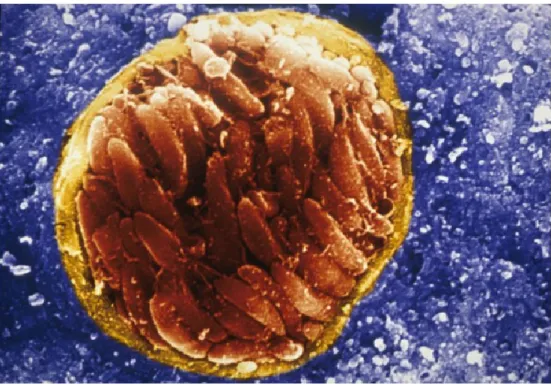 Figura 7A. Cisti tissutale di T. gondii contenente bradizoiti localizzata nel tessuto cerebrale di un topo infetto vista al microscopio  elettronico a scansione (Ferguson D., Oxford University)
