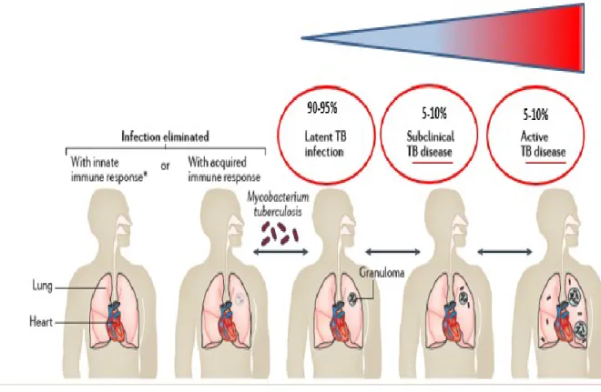 Figure 1.4: The spectrum of TB from M. tuberculosis infection to active disease (Pai et al., 2016) 