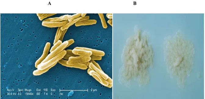 Figure  1.6  :  M.  tuberculosis  scanning  electron  micrograph.  Mag  15549X  (a),  Colonies  of                       M